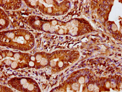 Immunohistochemistry (Formalin/PFA-fixed paraffin-embedded sections) - Anti-CCDC6 antibody (AB235912)