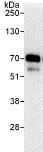 Immunoprecipitation - Anti-CCDC6 antibody (AB85923)