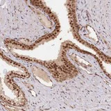 Immunohistochemistry (Formalin/PFA-fixed paraffin-embedded sections) - Anti-CCDC65 antibody (AB122482)