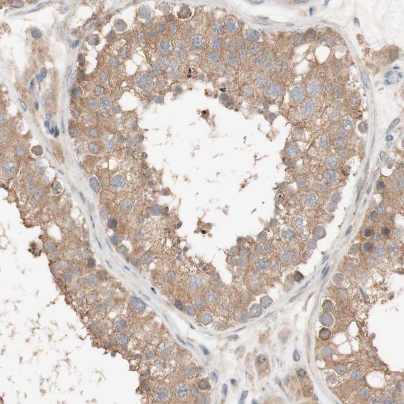 Immunohistochemistry (Formalin/PFA-fixed paraffin-embedded sections) - Anti-CCDC67 antibody (AB246896)