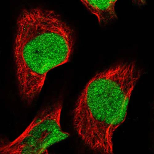 Immunocytochemistry/ Immunofluorescence - Anti-CCDC75 antibody (AB122451)