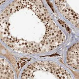 Immunohistochemistry (Formalin/PFA-fixed paraffin-embedded sections) - Anti-CCDC75 antibody (AB122451)