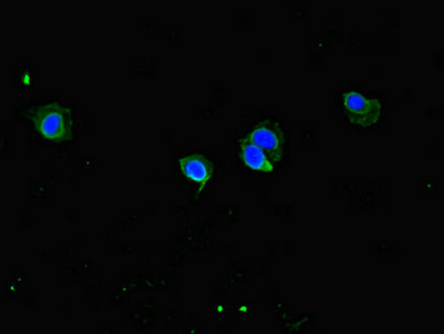 Immunocytochemistry/ Immunofluorescence - Anti-CCDC8 antibody (AB222969)