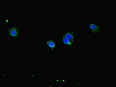 Immunocytochemistry/ Immunofluorescence - Anti-CCDC8 antibody (AB222969)