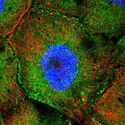 Immunocytochemistry/ Immunofluorescence - Anti-CCDC8 antibody (AB223784)