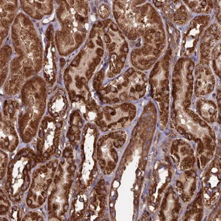 Immunohistochemistry (Formalin/PFA-fixed paraffin-embedded sections) - Anti-CCDC8 antibody (AB223784)