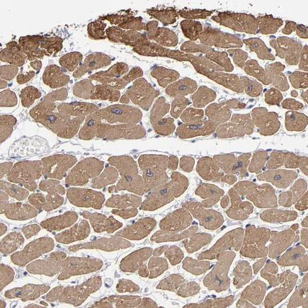 Immunohistochemistry (Formalin/PFA-fixed paraffin-embedded sections) - Anti-CCDC80 antibody (AB224050)