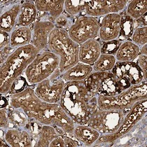 Immunohistochemistry (Formalin/PFA-fixed paraffin-embedded sections) - Anti-CCDC81 antibody (AB126514)