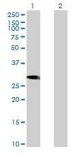 Western blot - Anti-CCDC88B antibody (AB173457)
