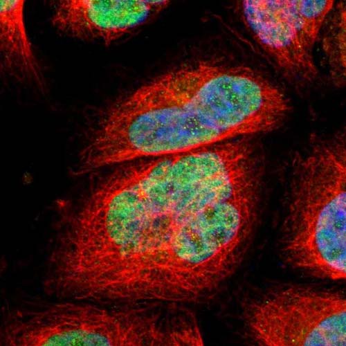 Immunocytochemistry/ Immunofluorescence - Anti-CCDC88C antibody (AB121235), expandable thumbnail