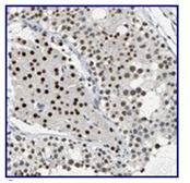 Immunohistochemistry (Formalin/PFA-fixed paraffin-embedded sections) - Anti-CCDC88C antibody (AB121235), expandable thumbnail