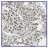 Immunohistochemistry (Formalin/PFA-fixed paraffin-embedded sections) - Anti-CCDC88C antibody (AB121235)