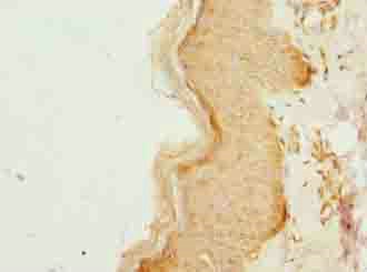 Immunohistochemistry (Formalin/PFA-fixed paraffin-embedded sections) - Anti-CCDC89 antibody (AB235780), expandable thumbnail
