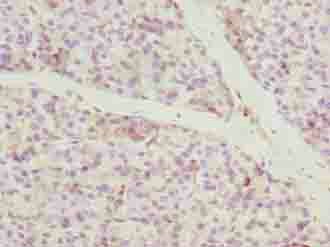 Immunohistochemistry (Formalin/PFA-fixed paraffin-embedded sections) - Anti-CCDC89 antibody (AB235780), expandable thumbnail