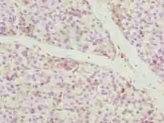 Immunohistochemistry (Formalin/PFA-fixed paraffin-embedded sections) - Anti-CCDC89 antibody (AB235780)