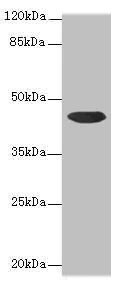 Western blot - Anti-CCDC89 antibody (AB235780)