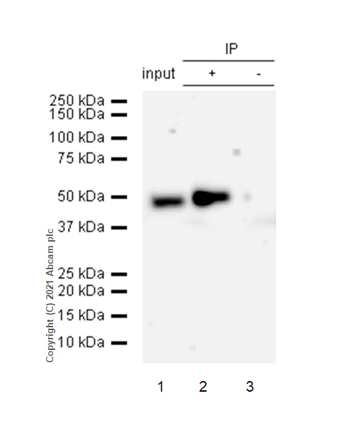 Immunoprecipitation - Anti-CCDC98 antibody [EPR6310(2)] - BSA and Azide free (AB248872)
