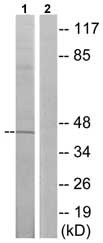 Western blot - Anti-CCK1-R antibody (AB75153), expandable thumbnail