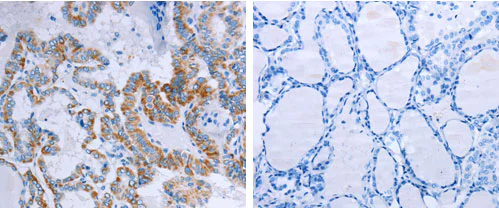 Immunohistochemistry (Formalin/PFA-fixed paraffin-embedded sections) - Anti-CCK2-R antibody (AB183124)