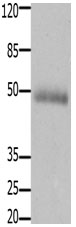 Western blot - Anti-CCK2-R antibody (AB183124), expandable thumbnail