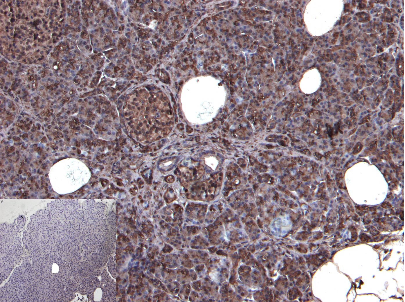 Immunohistochemistry (Formalin/PFA-fixed paraffin-embedded sections) - Anti-CCK2-R antibody (AB77077)