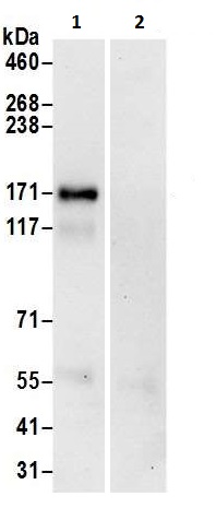 Immunoprecipitation - Anti-CCK4 antibody (AB225874), expandable thumbnail