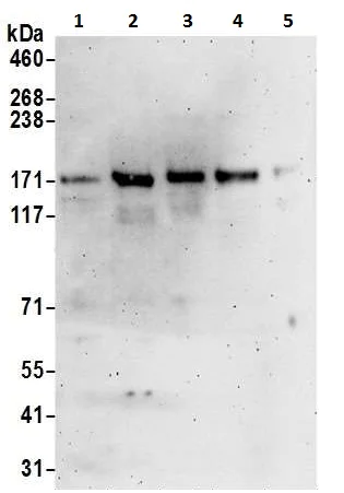Western blot - Anti-CCK4 antibody (AB225874)
