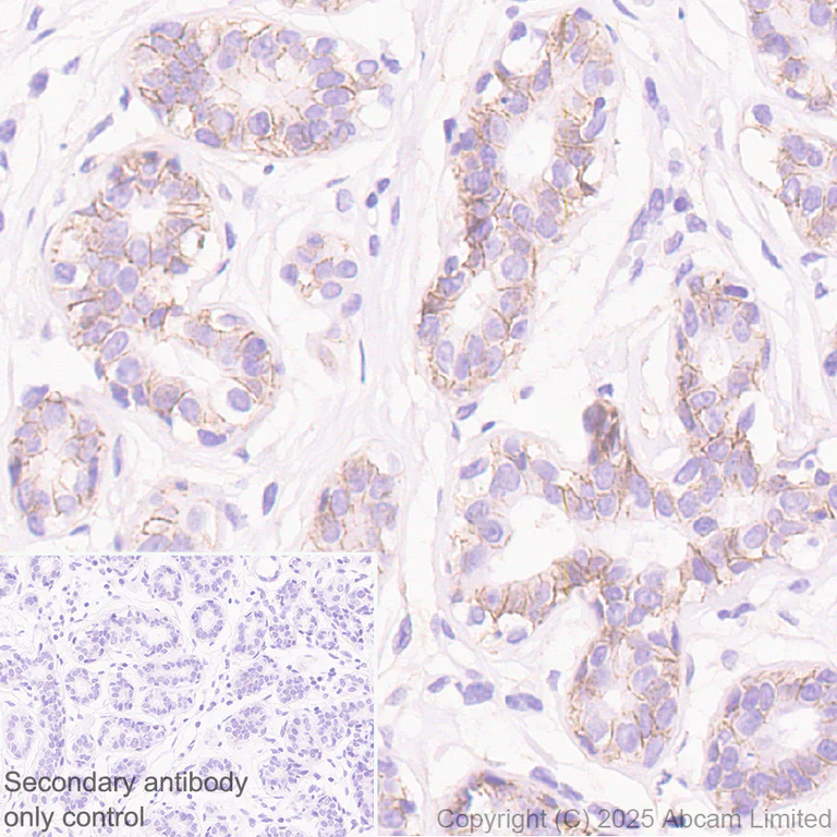 Immunohistochemistry (Formalin/PFA-fixed paraffin-embedded sections) - Anti-CCK4 antibody [EPR30150-507] (AB325170)