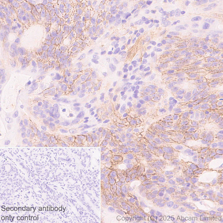 Immunohistochemistry (Formalin/PFA-fixed paraffin-embedded sections) - Anti-CCK4 antibody [EPR30150-507] (AB325170)