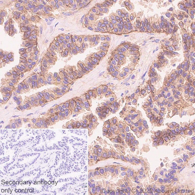 Immunohistochemistry (Formalin/PFA-fixed paraffin-embedded sections) - Anti-CCK4 antibody [EPR30150-507] (AB325170)