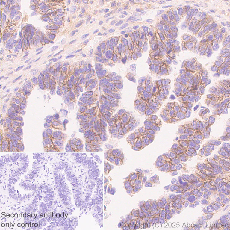 Immunohistochemistry (Formalin/PFA-fixed paraffin-embedded sections) - Anti-CCK4 antibody [EPR30150-507] (AB325170)