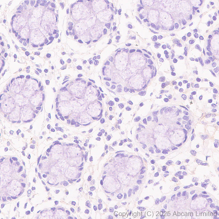 Immunohistochemistry (Formalin/PFA-fixed paraffin-embedded sections) - Anti-CCK4 antibody [EPR30150-507] (AB325170)