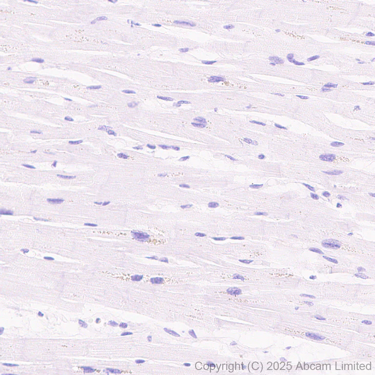 Immunohistochemistry (Formalin/PFA-fixed paraffin-embedded sections) - Anti-CCK4 antibody [EPR30150-507] (AB325170)