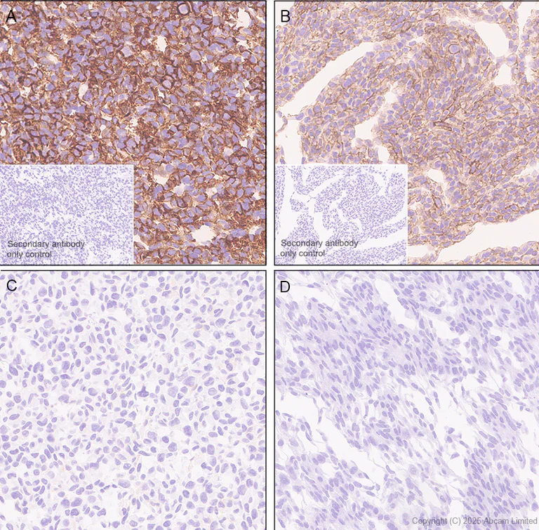 Immunohistochemistry (Formalin/PFA-fixed paraffin-embedded sections) - Anti-CCK4 antibody [EPR30150-507] (AB325170)