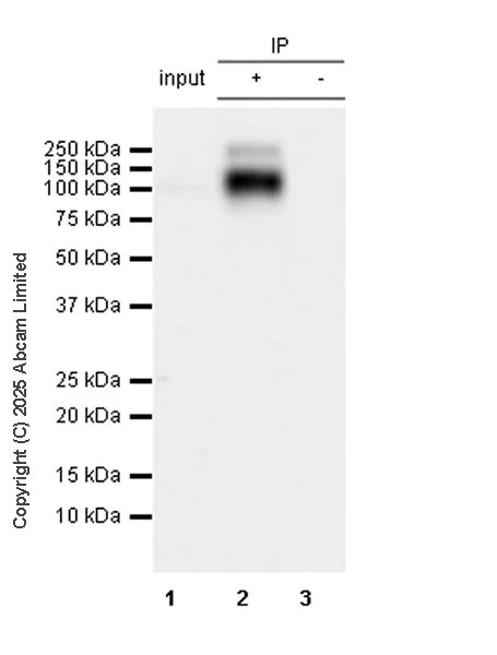 Immunoprecipitation - Anti-CCK4 antibody [EPR30150-507] (AB325170)
