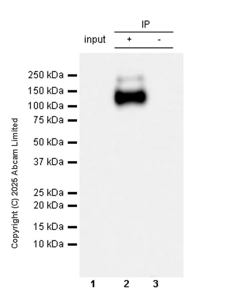 Immunoprecipitation - Anti-CCK4 antibody [EPR30150-507] (AB325170)
