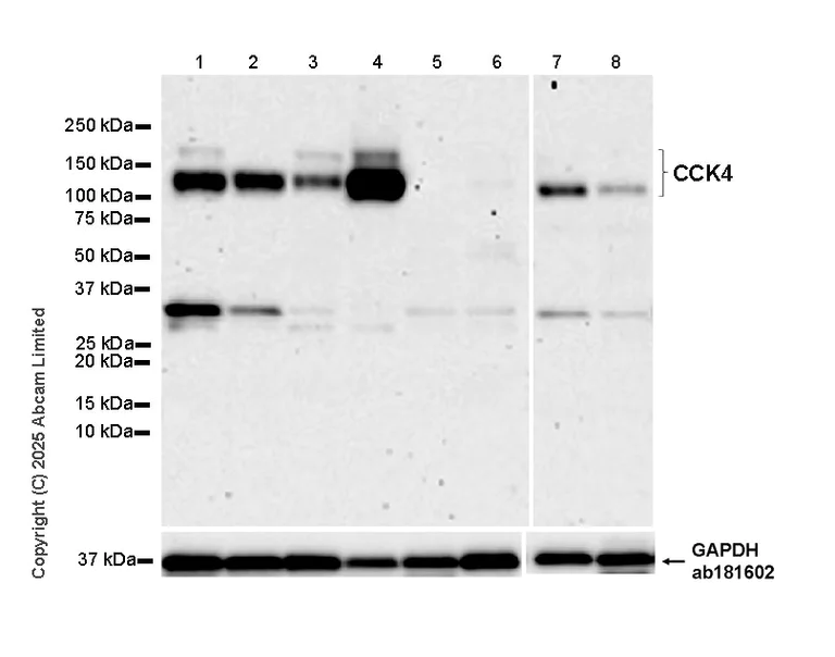 Western blot - Anti-CCK4 antibody [EPR30150-507] (AB325170)