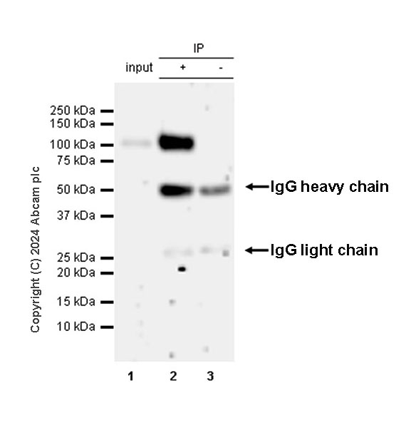 Immunoprecipitation - Anti-CCK4 antibody [EPR30150-524] (AB323570), expandable thumbnail