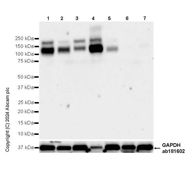 Western blot - Anti-CCK4 antibody [EPR30150-524] (AB323570), expandable thumbnail