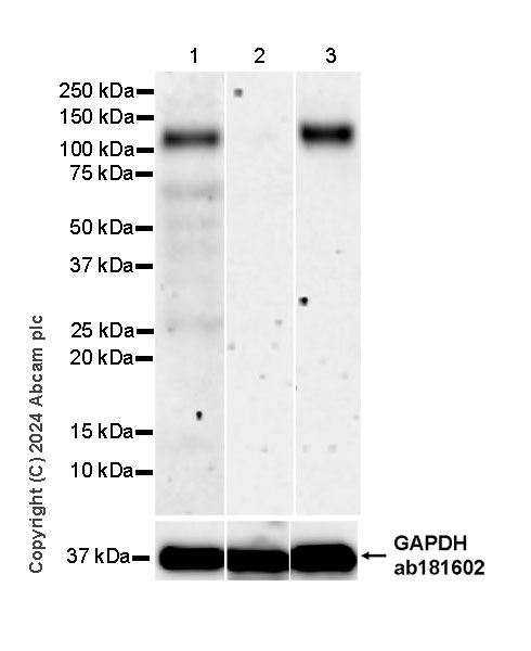 Western blot - Anti-CCK4 antibody [EPR30150-524] (AB323570), expandable thumbnail