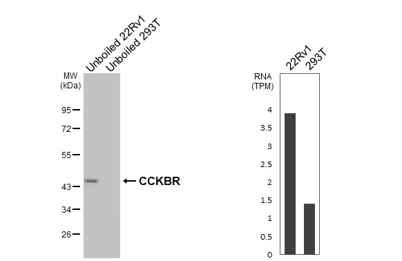 Western blot - Anti-CCKBR antibody [HL4404] - BSA and Azide free (AB327602)