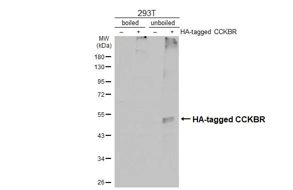 Western blot - Anti-CCKBR antibody [HL4404] - BSA and Azide free (AB327602)