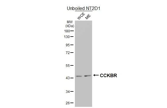 Western blot - Anti-CCKBR antibody [HL4404] - BSA and Azide free (AB327602)