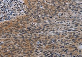 Immunohistochemistry (Formalin/PFA-fixed paraffin-embedded sections) - Anti-CCL1 antibody (AB198828), expandable thumbnail