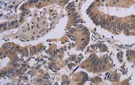 Immunohistochemistry (Formalin/PFA-fixed paraffin-embedded sections) - Anti-CCL1 antibody (AB198828), expandable thumbnail