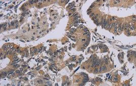 Immunohistochemistry (Formalin/PFA-fixed paraffin-embedded sections) - Anti-CCL1 antibody (AB198828)