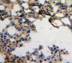 Immunohistochemistry (Formalin/PFA-fixed paraffin-embedded sections) - Anti-CCL18 antibody (AB233099)
