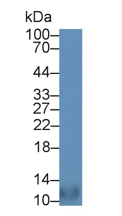 Western blot - Anti-CCL18 antibody (AB233099)