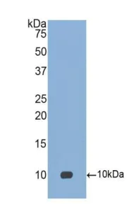 Western blot - Anti-CCL18 antibody (AB233099)