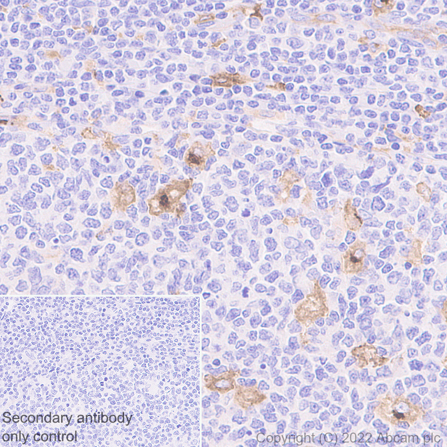 Immunohistochemistry (Formalin/PFA-fixed paraffin-embedded sections) - Anti-CCL18 antibody [EPR24781-84] (AB300057)